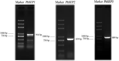 Characterization of Three SEPALLATA-Like MADS-Box Genes Associated With Floral Development in Paphiopedilum henryanum (Orchidaceae)